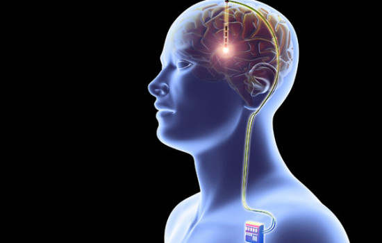 এবার মানব মস্তিষ্কে বসবে মেমোরি কার্ড!