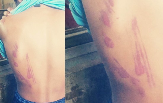 ছাত্রকে বেধড়ক পেটালেন মাদ্রাসা শিক্ষক