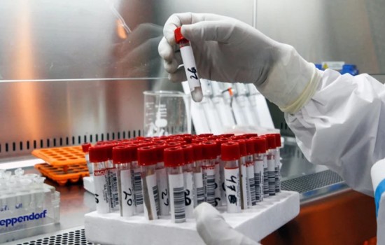 দেশে করোনায় শনাক্ত বেড়েছে