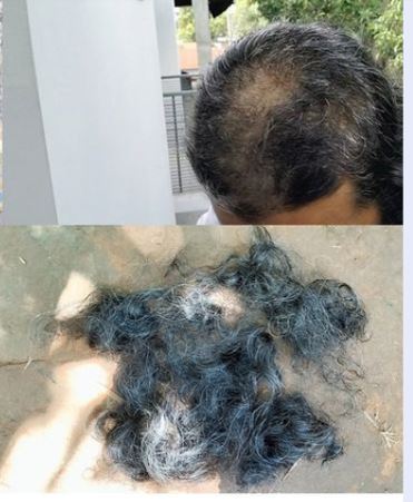 শেরপুরে পীরের মুরিদানকে চুলকেটে দেওয়ায় থানায় অভিযোগ