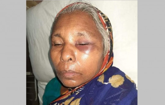 শাশুড়িকে প্রকাশ্যে মারধর করায় পুত্রবধূ গ্রেফতার