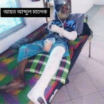 ধুনটে পাগলকে মারপিট থানায় অভিযোগ