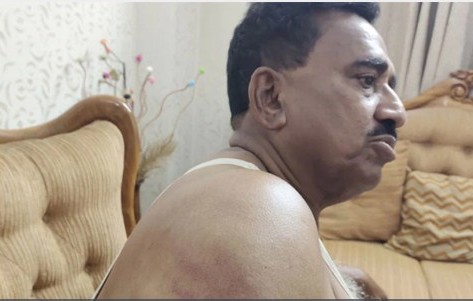 সাবেক এমপি ও বিএনপি নেতা শাহজাহান খানের ওপর হামলা