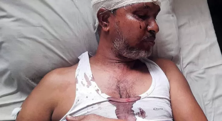 আদমদীঘিতে আওয়ামীলীগ নেতাকে হত্যার উদ্দেশ্যে মারপিট মোটরসাইকেল ও টাকা ছিনতাই