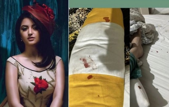 বালিশ ও বিছানায় রক্তের ছবি দিয়ে যা বললেন পরীমণি