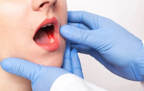 যেসব ভুলে হতে পারে ওরাল ক্যানসার