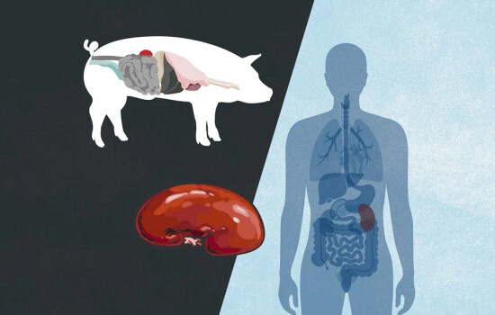 চিকিৎসাবিজ্ঞানে নতুন সাফল্যের দাবি, মানবদেহে কাজ করছে শূকরের কিডনি!