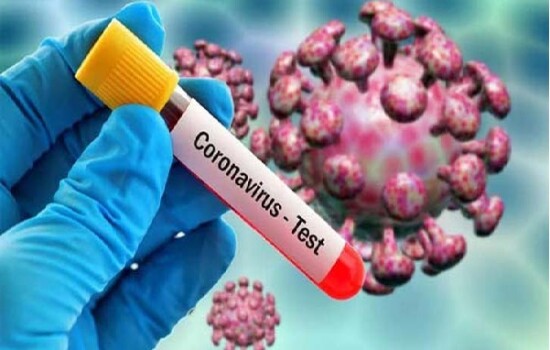 ২৪ ঘণ্টায় ২৮ জনের করোনা শনাক্ত