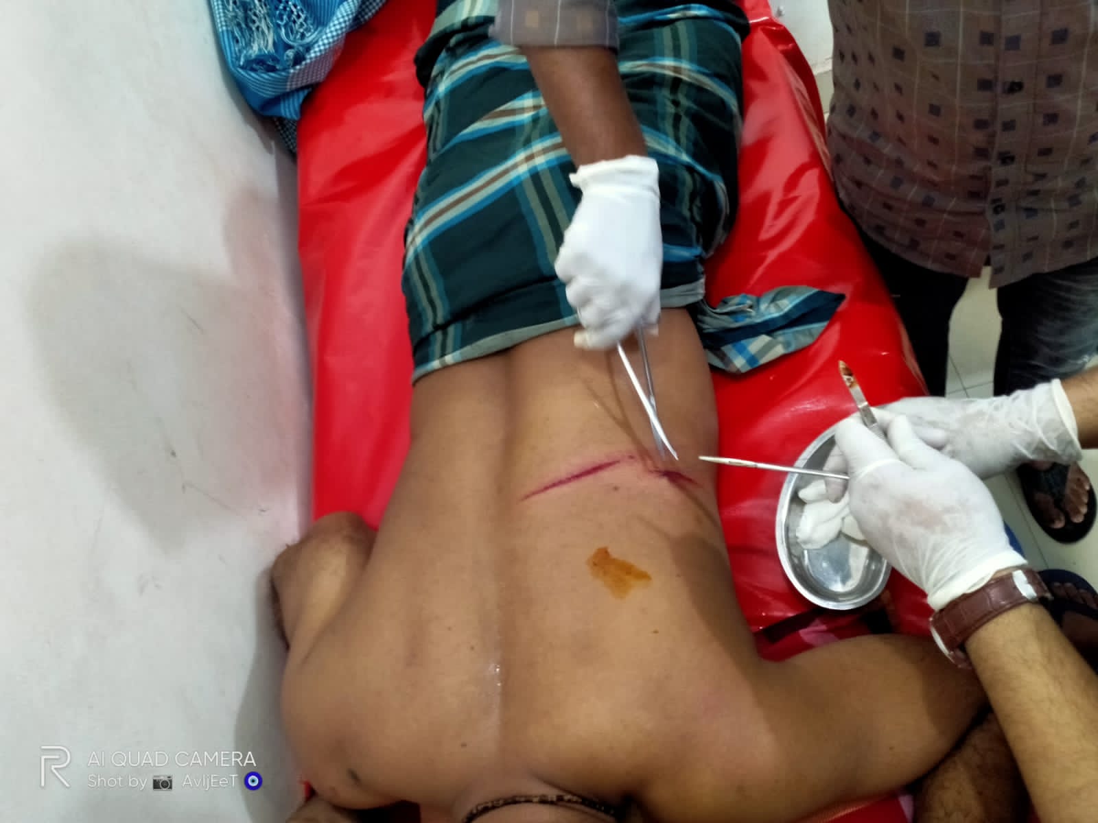 দাউদকান্দিতে স্বতন্ত্র প্রার্থী ঈগল সর্মথকদের হামলায় নৌকা প্রতিকের দুই সংখ্যালঘু আহত