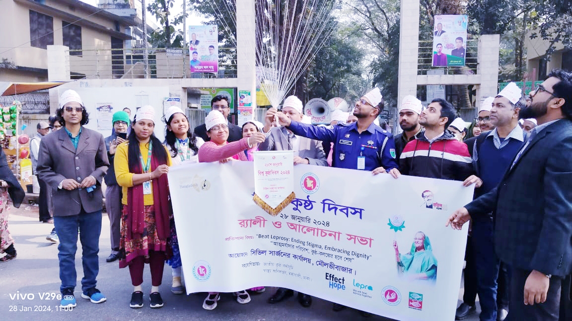 মৌলভীবাজার জেলার কুষ্ঠ রোগ নির্মূল সম্ভব- সম্মিলিত প্রচেষ্টায় ২বছরের মধ্যে