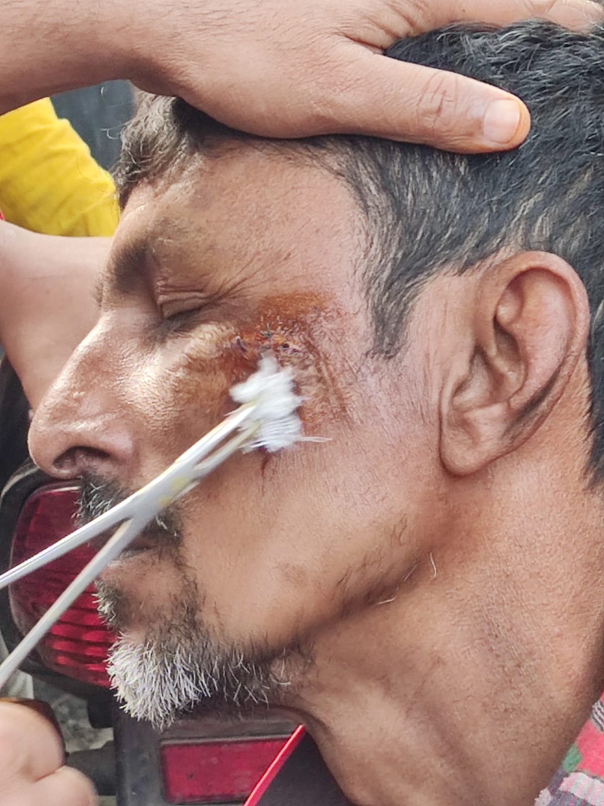 আবারো রফিক বাহিনীর তাণ্ডবে রক্তাক্ত নাওড়া