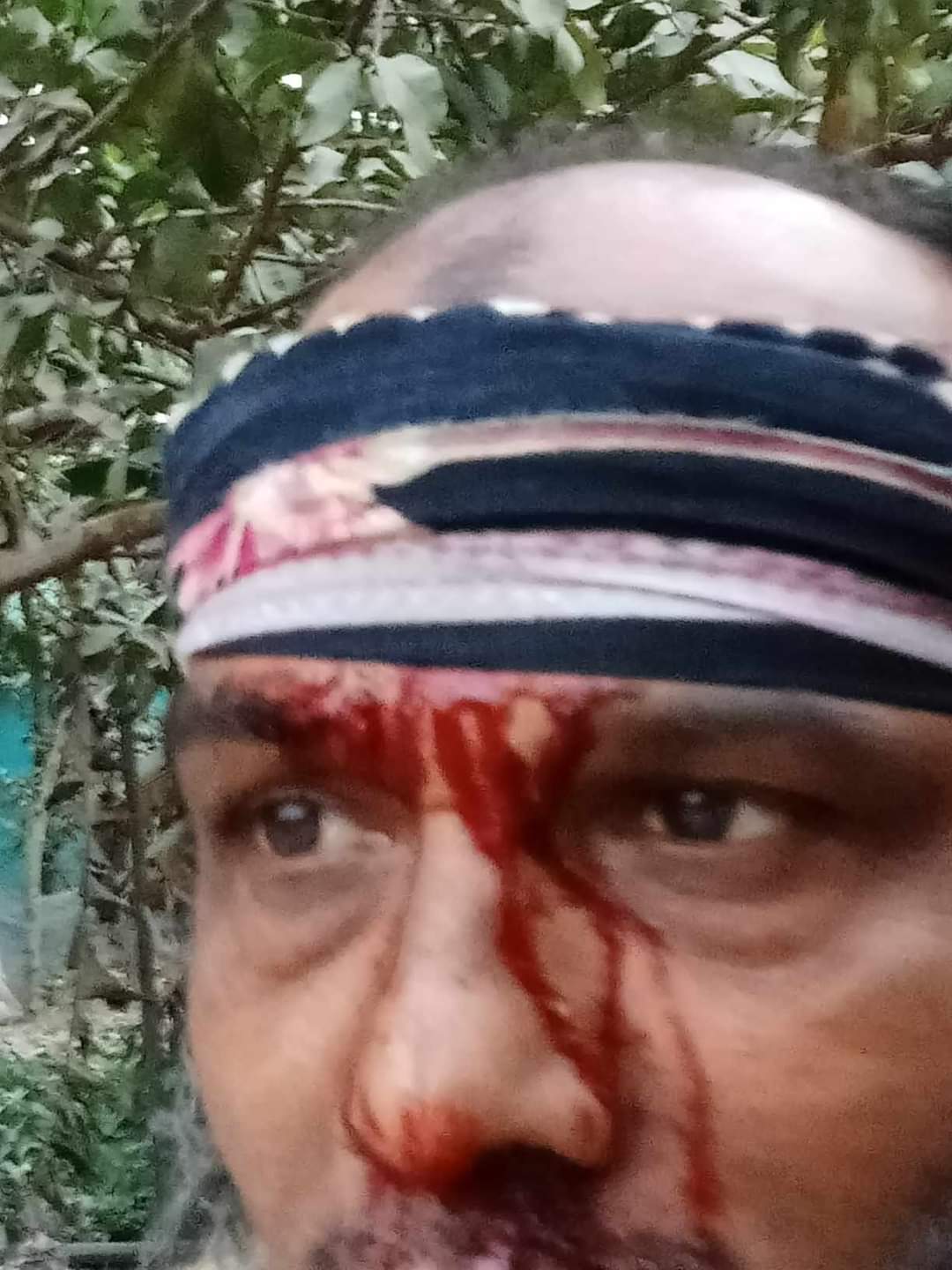 রূপগঞ্জে গুলিবিদ্ধ ১১ বছরের শিশু, চতুর্থ বারের মত রক্তাক্ত নাওড়া