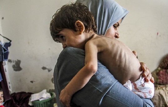 গাজায় অর্ধলক্ষাধিক শিশুর জরুরি চিকিৎসা প্রয়োজন: জাতিসংঘ