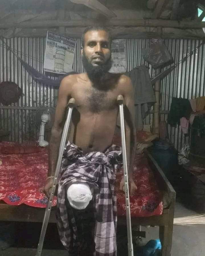 দাউদকান্দির হাসানের সহযোগিতা প্রয়োজন