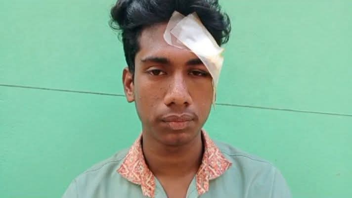 আশুলিয়ায় কিশোর গ্যাং সদস্যদের হামলার শিকার শিক্ষার্থী, থানায় অভিযোগ