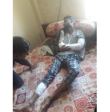 সীতাকুণ্ডে জামায়াত নেতার পায়ের রগ কেটে দিলো দুর্বৃত্তরা