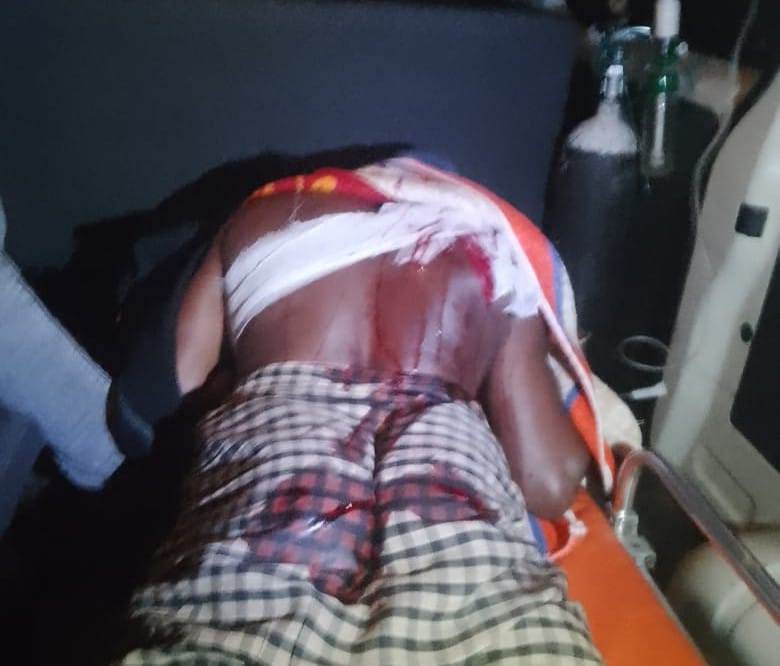 কয়রায় প্রতিপক্ষের ছুরিকাঘাতে গুরুতর জখম ৩