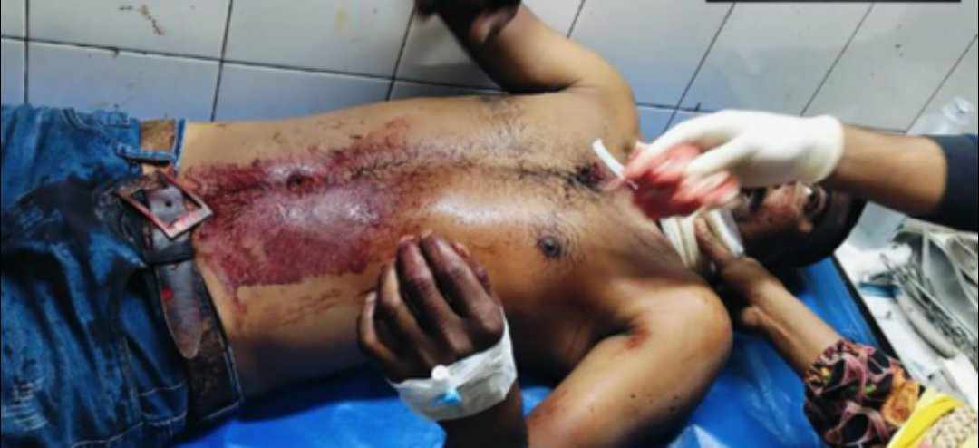 গোয়ালন্দে মাসুদ নামে এক যুবককে কুপিয়ে গুরুতর জখম করেছে সন্ত্রাসীরা