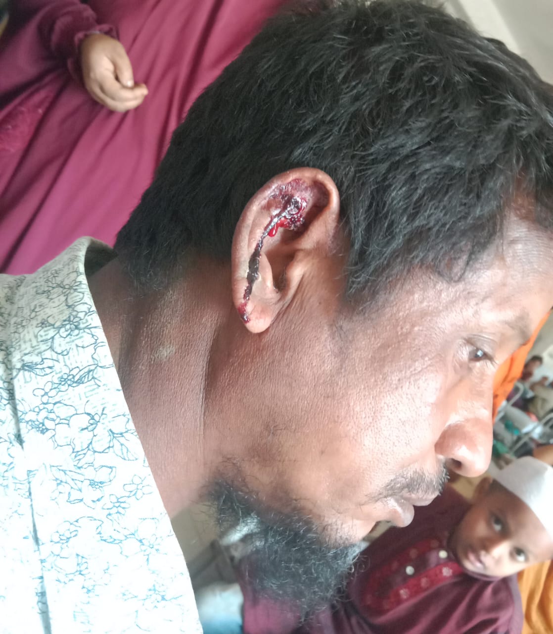 বান্দরবানের সুয়ালকে জমি নিয়ে বিরোধের জেরে স্বামী স্ত্রী দুইজনকে কুপিয়ে জখম