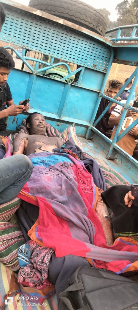 সাজেকে আগুনে পুড়ে জুম চাষির মৃত্যু