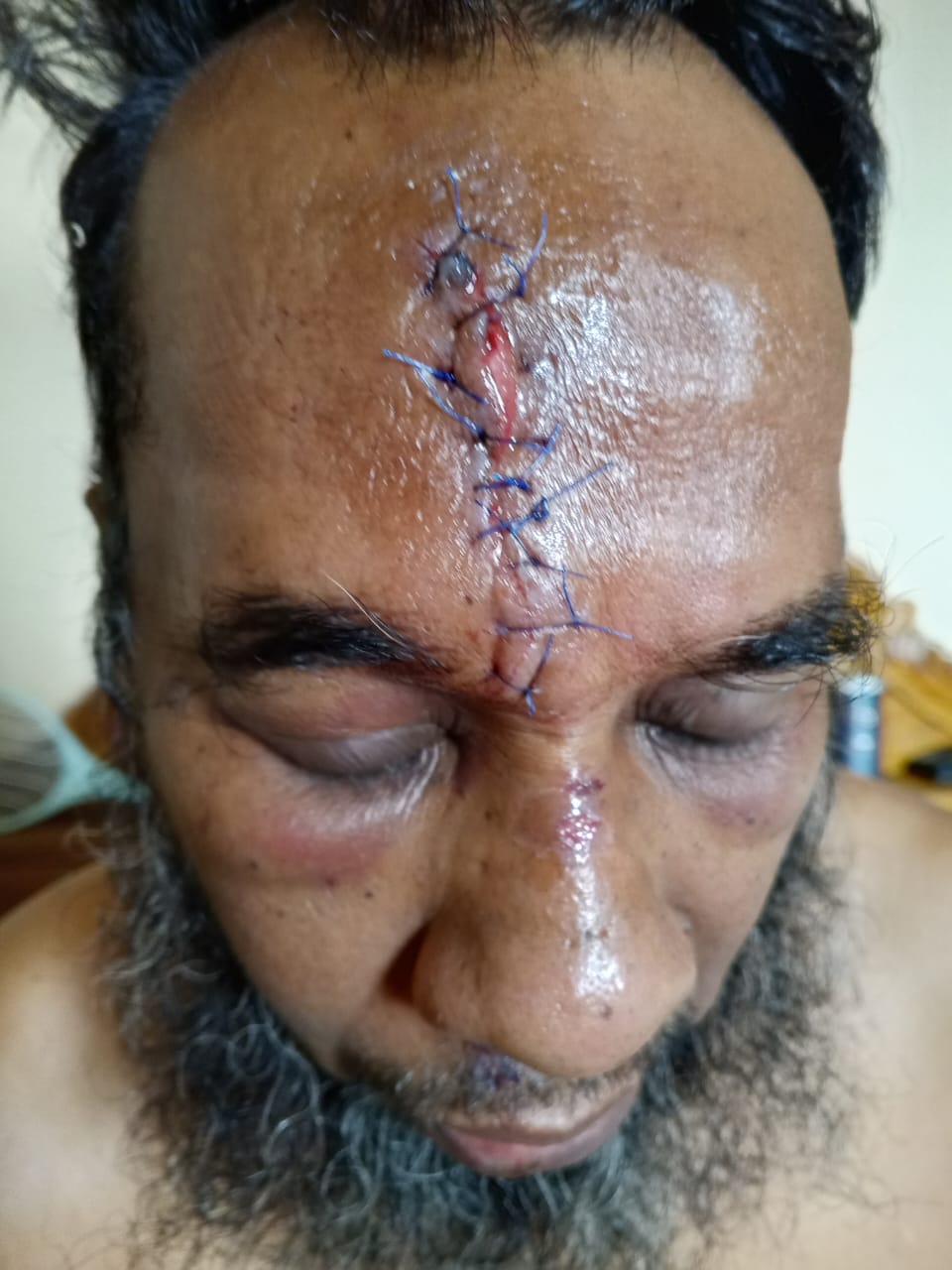 ডা. জামান উদ্দিন সড়ক দুর্ঘটনায় গুরুতর আহত—আন্তর্জাতিক আইনি প্রতিকার ফাউন্ডেশনের গভীর শোক ও দোয়ার আহ্বান