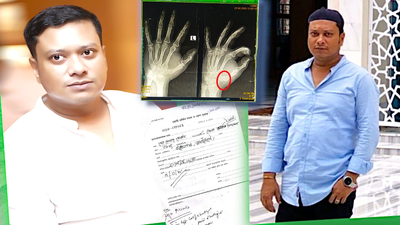 জয়পুরহাটে জুয়ার আসরে ছবি তুলতে গিয়ে হামলার শিকার সাংবাদিক নোমান