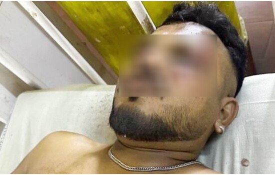 বিমান বিধ্বস্তে ২৪১ যাত্রী নিহত, অলৌকিকভাবে বেঁচে গেলেন এক যুবক