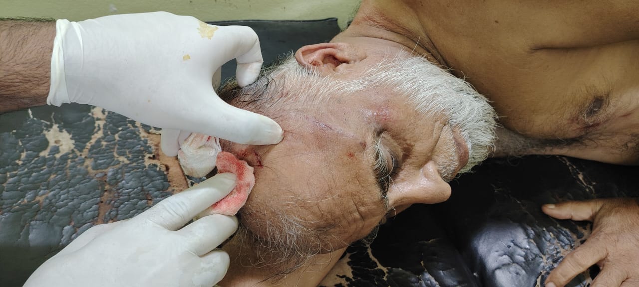 গোয়ালমারী ইউনিয়নে বিএনপি কমিটি ঘিরে সংঘর্ষ, আহত উপজেলা বিএনপি নেতা