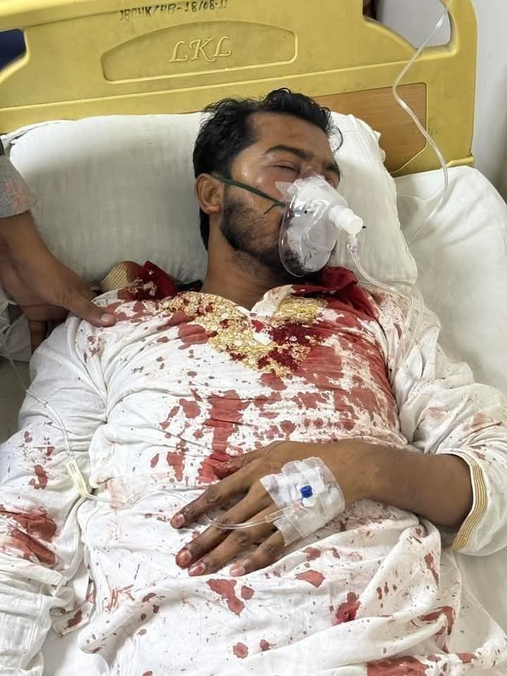 জাতীয় পার্টি ও আওয়ামী লীগের সন্ত্রাসীরা হামলা নুরুল হক নুর আহত 