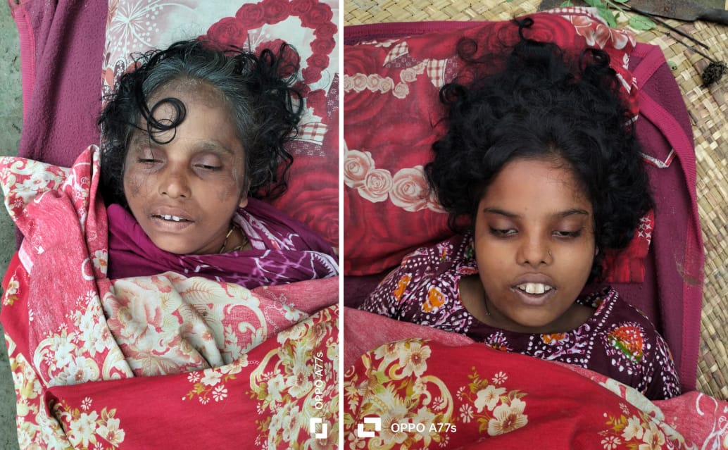 এনজিও’র ঋণের চাপ ও অভাবে কুমিল্লার বুড়িচংয়ে মা-মেয়ের আ ত্মহ ত্যা