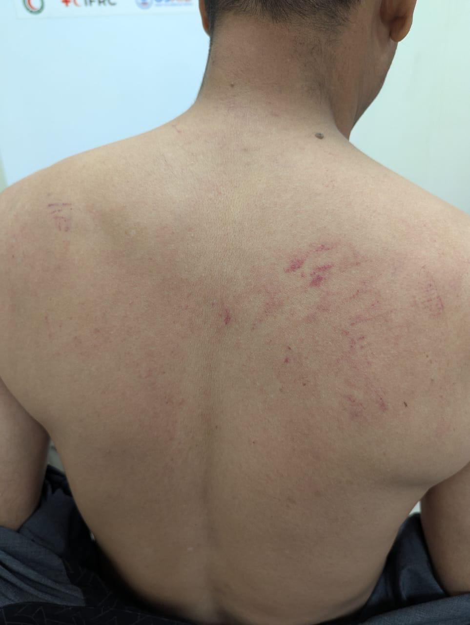 আইইবি’র সহকারী সাধারণ সম্পাদক প্রকৌশলী আহসানুল রাসেলের ওপর অতর্কিত হামলা