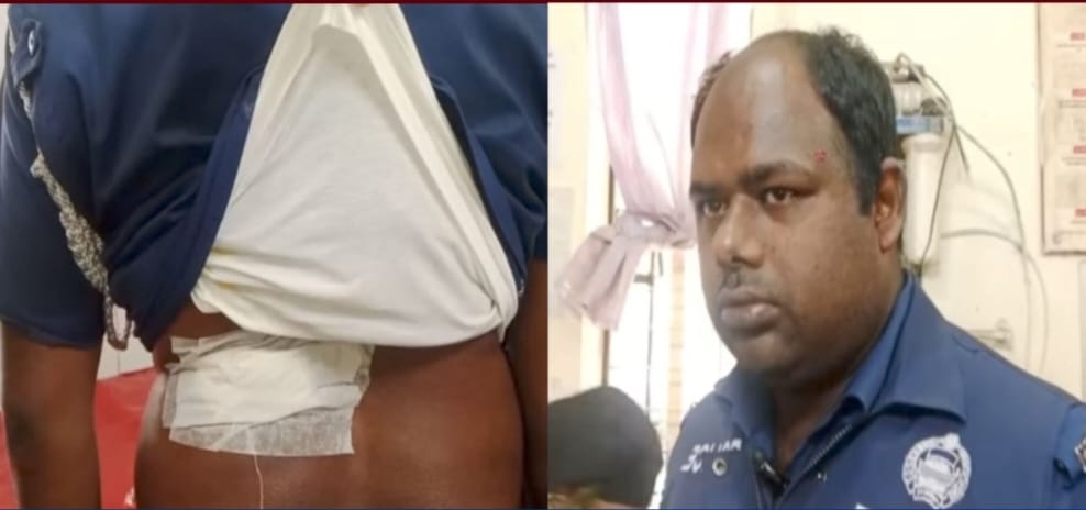 ফেনীর পরশুরামে অভিযুক্ত সন্ত্রাসীদের হামলায় এসআইসহ তিন পুলিশ সদস্যা আহত