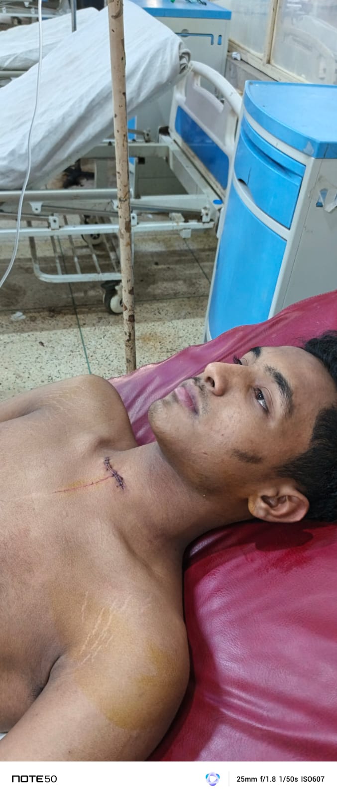 ফেঞ্চুগঞ্জে সালিশ বৈঠকে পরিকল্পিত হামলা: শ্বাসনালী কেটে হত্যার চেষ্টা, এলাকায় উত্তেজনা