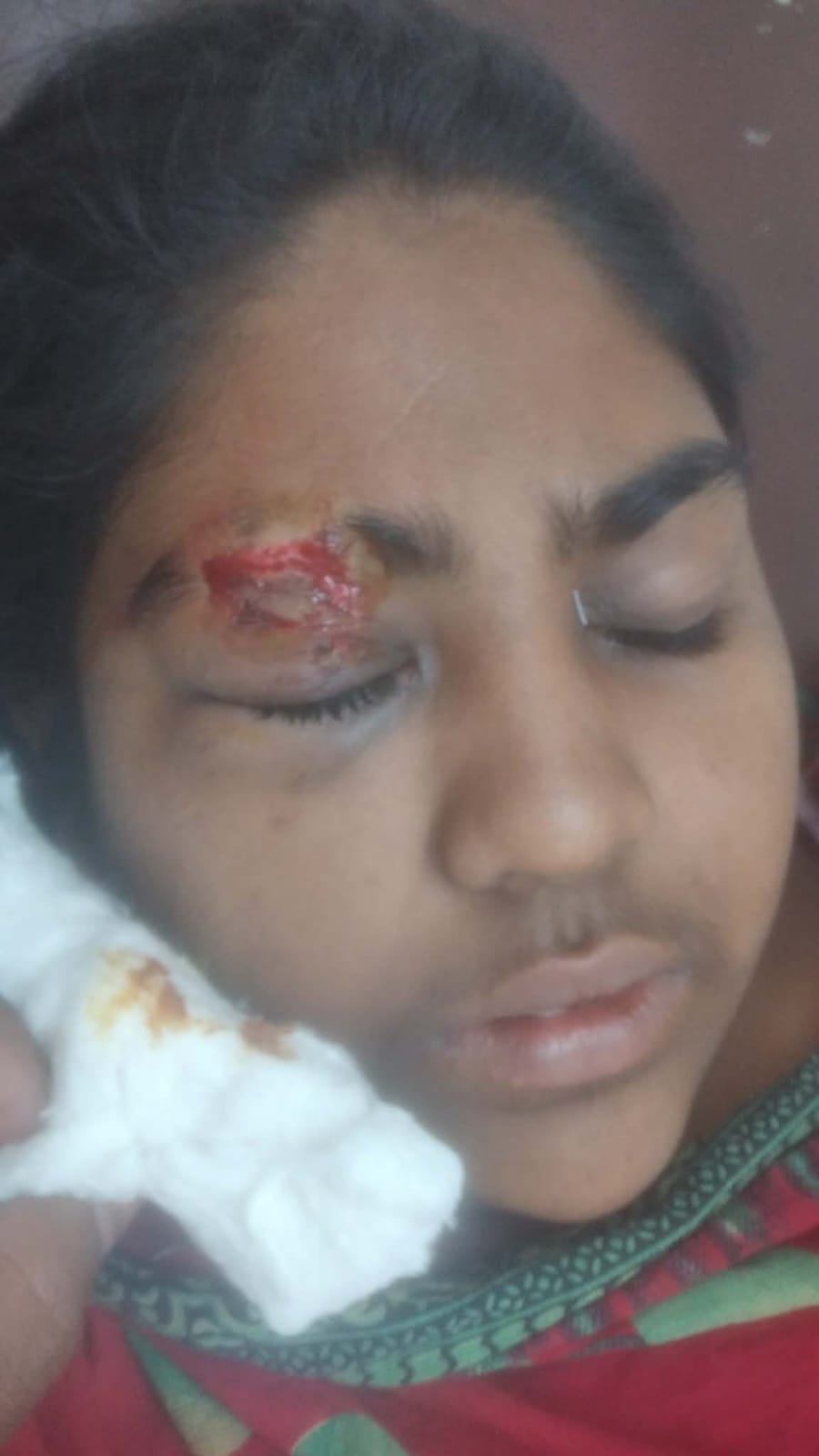 বীরগঞ্জে জমি দখলের পায়তারা, হামলায় নারী-শিশুসহ আহত ৪ : এলাকায় চরম উত্তেজনা।