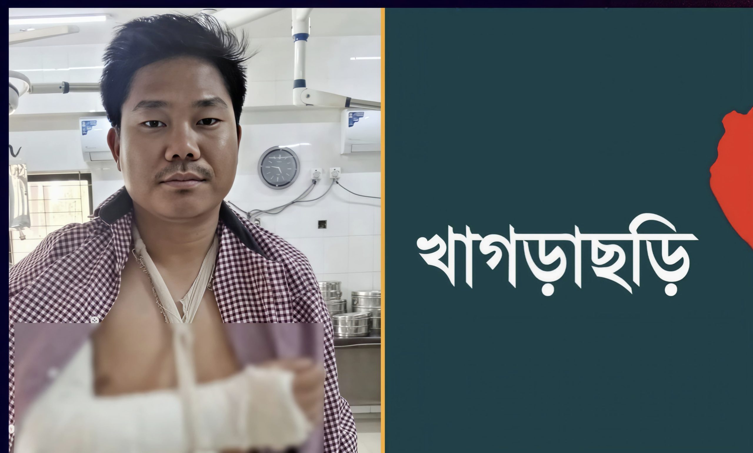 খাগড়াছড়িতে অকটেন না দেওয়ায় ট্যাগ অফিসারের ওপর হামলা, হাত ভেঙে আহত