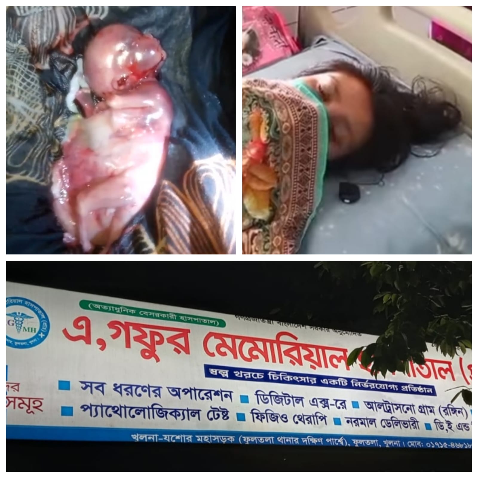 খুলনার ফুলতলায় এ গফুর মেমোরিয়াল হাসপাতালে প্রসূতি চিকিৎসা নিয়ে চাঞ্চল্যকর অভিযোগ।