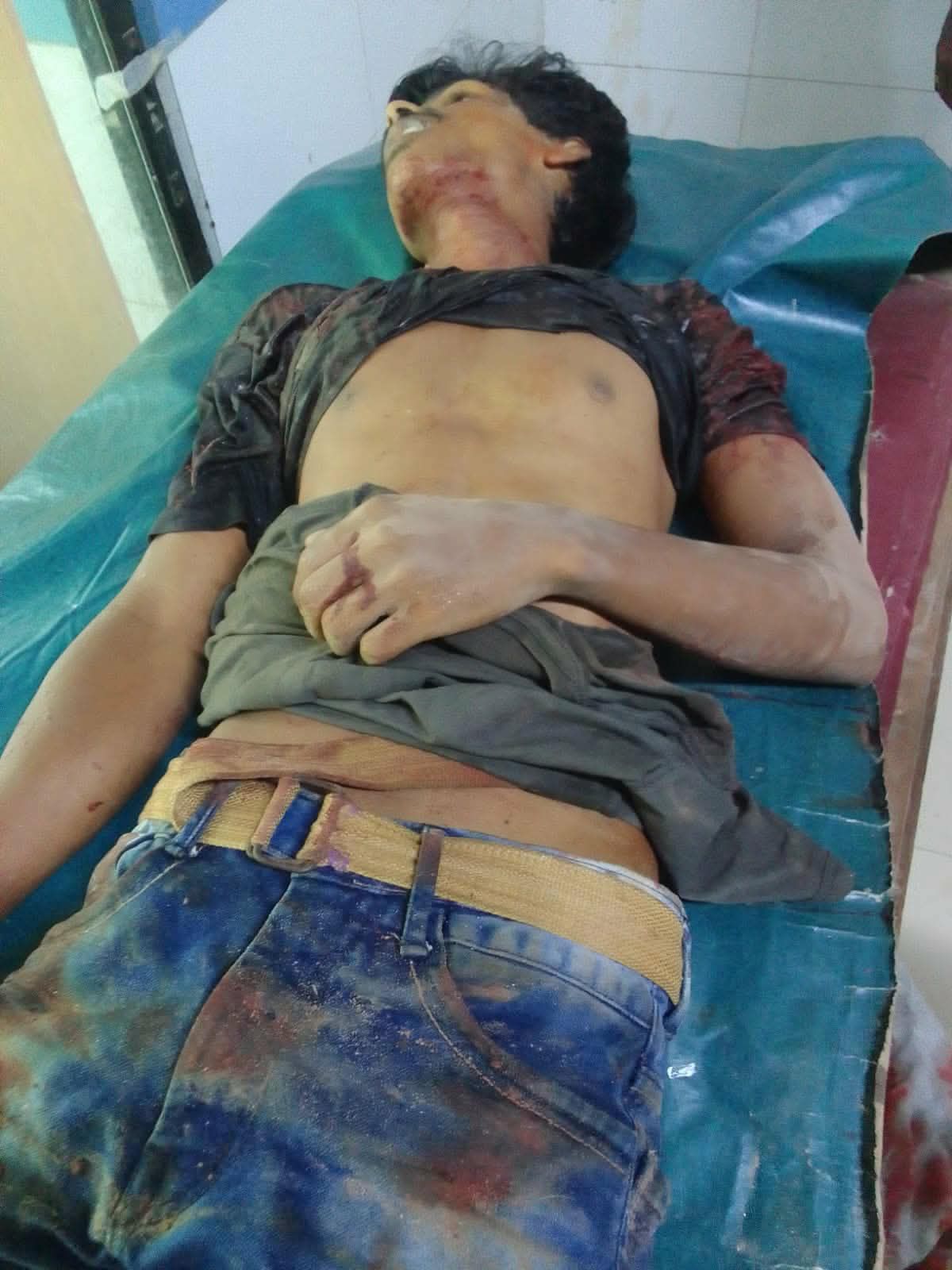 খুলনায় দূর্বৃত্তের অস্ত্রের আঘাতে যুবক খুন।